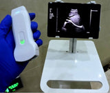 sonda ecografica ad ultrasuoni portatile convessa