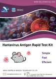 TEST HANTAVIRUS, SCONTO 50 PEZZI!
